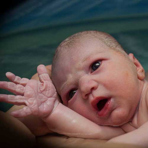 Waterbirth baby