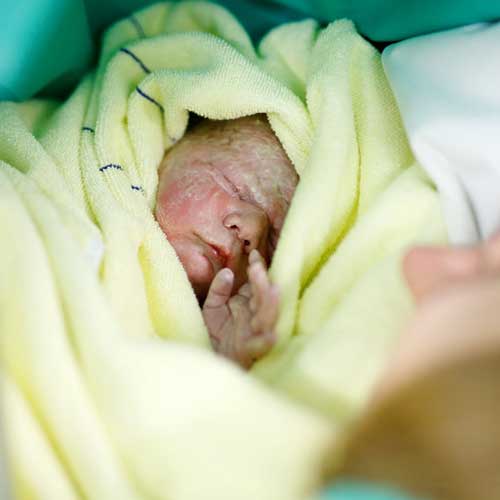 caesarean birth